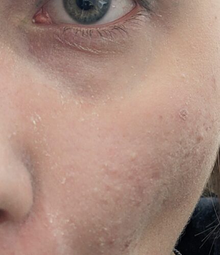 Сонцезахисний крем для нейтралізації почервонінь Dr. Ceuracle Tea Tree Purifine Green Up Sun SPF 50 photo review