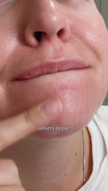 ЗЕЛЕНЕ ОЧИЩЕННЯ💚

Вау-засіб 4-в-1, який поєднує в собі властивості гідрофільної олійки, пінки для вмивання, маски для очищення пор та мʼякого пілінгу 🤭

Класно піниться, ефективно очищує, не стягує та не пересушує 🙌🏻

Вам вже це треба? Забирайте свій на ALL-FACE.COM.UA, або завітайте та протестуйте в одному з наших просторів:

📍 Київ, вул. Шота Руставелі, 34
📍 Одеса, вул. Рішельєвська, 13