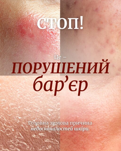 Пошкоджений захисний бар’єр — головний винуватець зимових висипань та сухості 🥲❄️

У новому дописі розповідаємо, чому це відбувається, до чого призводить та як повернути шкірі комфорт і здоровий вигляд. Гортайте 👉🏻

А якщо хочете отримати індивідуальний підбір догляду — залишайте ➕ в коментарях. Наші консультанти допоможуть Вам БЕЗКОШТОВНО 🤍