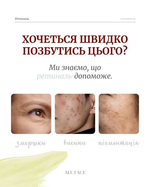 Все, що варто знати про РЕТИНАЛЬ 🫶🏻

📌 Гортайте, зберігайте та користуйтеся — ваша шкіра заслуговує на найкраще! 

Свята тривають — знижки теж! Ретиналь Dr.Different з фантастичною вигодою до -40%! 🔥

Результати вже через 5 тижнів:
🤍 Менше зморшок
🤍 Світліше та рівніше обличчя
🤍 Сяюча, оновлена шкіра, яка привертає погляди

🛒 Доступно онлайн та у магазинах ALL FACE. 
Реальні відгуки та вау-результати НА САЙТІ! 

Посилання в шапці профілю ✅