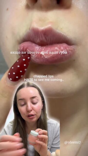 Рятівник для губ взимку! 👄

Щільний шар цієї маски на ніч — будь-які лущення буквально стерті з Ваших губ. І це не магія, а дійсно робоча формула, адже у складі:

🤍 Оливкова олія — інтенсивно зволожує та підтримує відновлення
🤍 Олія жожоба — пом’якшує, заспокоює, сприяє регенерації
🤍 Олія насіння малини — антиоксидантний захист і комфорт для губ
🤍 Олія насіння моринги — живить, розгладжує, повертає м’якість
🤍 Вітамін Е — захищає, зволожує та підтримує гладкість шкіри

✨ Результат: губи виглядають доглянутими вже після першої ночі.

А що це за диво-баночка? Дивіться у відео 🫰

📎 Придбати можна за посиланням у шапці профілю