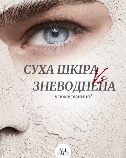 Шкіра суха чи зневоднена? Як відрізнити та який догляд потрібен? 🤔

Це важливо, бо сухість і зневоднення легко сплутати. Можна купувати щільні живильні креми, а шкіра все одно буде стягнутою, тьмяною або подразненою.  Це може означати, що їй потрібен інший підхід.

▫️ Сухій шкірі частіше потрібні живлення, ліпіди й підтримка бар’єра. 
▫️ Для зневодненої важливі зволоження, м’яке відновлення та засоби, які допоможуть утримувати вологу. 

У каруселі розібрали, як відрізнити сухість від зневоднення та який базовий догляд може допомогти в кожному випадку.

Збережіть пост, щоб повернутися до нього перед наступною покупкою догляду ✅

А якщо після каруселі ви ще не впевнені, чого зараз потребує ваша шкіра: зволоження, живлення чи відновлення бар’єра, напишіть нам у Direct. Ми допоможемо підібрати засоби під ваш запит 💌