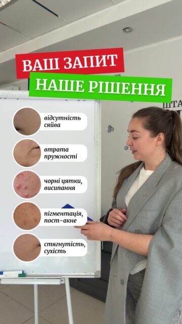 Є така проблема зі шкірою? Ось що допоможе.

❌ Втрата сяйва?
✅ Ніацинамід
Orien Propolis Niacinamide Glow Serum — 805 грн (арт. 83571)

❌ Хочете більше пружності?
✅ Вітамін С
Dr.Different CEQ Anti-Oxidant Serum — 1489 грн (арт. 83152)

❌ Чорні цятки та висипання?
✅ Саліцилова кислота
Nine Less Molecule-Clear Salicylic Acid Serum — 720 грн (арт. 83432)

❌ Пігментація чи пост-акне?
✅ Транексамова кислота
Dr.Melaxin TX Cream — 1429 грн (арт. 83502)

❌ Стягнутість або сухість?
✅ Кераміди
Dr.Different 311 Moisturizer — 1419 грн (арт. 82081)

Яка проблема зі шкірою турбує найбільше? Напишіть нам у Direct — допоможемо підібрати догляд саме для вашої шкіри!