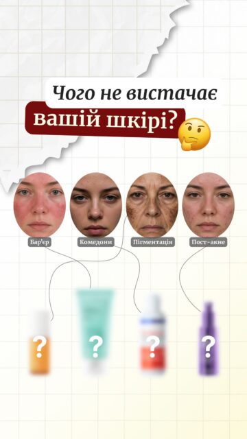 Чого потребує ця шкіра? 👀

Граємо та пояснюємо, чому саме ці засоби — найкраще рішення.

Якщо не знаєте, що потрібно саме вашій шкірі — пишіть у Direct. Наші консультанти безкоштовно допоможуть підібрати догляд! 🤍
