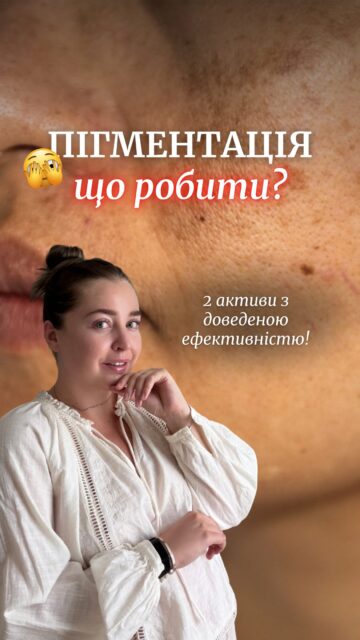 ПІГМЕНТАЦІЯ, НЕОДНОРІДНИЙ ТОН І ТЬМЯНІСТЬ ШКІРИ?
Іноді для помітних змін не потрібна складна рутина — достатньо всього 2 правильних засобів.

☀️ ВРАНЦІ — КИСЛИЙ ВІТАМІН С
Допомагає освітлювати пігментацію, працює як антиоксидант і додає шкірі сяйва. А використання під SPF допомагає додатково захищати шкіру від негативного впливу сонця.

Вітамін С Dr.Different — арт. 83152

🌙 УВЕЧЕРІ — РЕТИНАЛЬ
Стимулює оновлення шкіри, допомагає працювати з уже наявною пігментацією та запобігати появі нової.

Ретиналь Dr.Different:
0.05% — арт. 82084
0.10% — арт. 82085
0.15% — арт. 82089

Зберігайте, щоб не загубити просту схему боротьби з пігментацією ✨