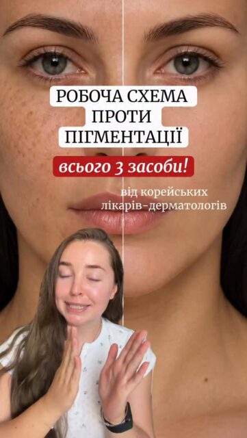ПІГМЕНТАЦІЯ? ОСЬ СХЕМА ВІД КОРЕЙСЬКОГО ДЕРМАТОЛОГА 🤫

1️⃣ Кислий вітамін С — зранку
L-аскорбінова кислота допомагає працювати з пігментацією та вирівнювати тон шкіри.

2️⃣ Ретиналь — увечері
Сприяє оновленню шкіри, працює з пігментацією та зморшками.

3️⃣ SPF — щодня
Захищає шкіру та допомагає попередити появу нової пігментації.

Найкомфортніші засоби для цієї схеми скинули в коментарі 👇