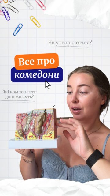 Комедони — це не просто «брудні пори», які треба підсушити ‼️

Тут важливі одразу кілька процесів: як відлущуються клітини, чи може себум нормально виходити з фолікула та якою є його структура. 

Саме тому в роботі з комедонами важливо впливати одразу на кілька ланок цього процесу 👇

• BHA-кислоти — працюють усередині пори та допомагають відлущувати клітини у фолікулі;
• ретиноїди — нормалізують процес відлущення й допомагають запобігати утворенню нових комедонів;
• лінолева кислота — цікава своєю здатністю підтримувати більш рідку консистенцію себуму

Цікавлять конкретні засоби? Залиште будь-який коментар — ми надішлемо найвдаліші!👇