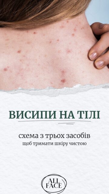 Турбують прищі на спині, у зоні декольте чи на сідницях? Ось чітка схема, як із ними працювати 🤌

Гелі, скраби, губки — здається, чим краще очищаємо шкіру, тим швидше мають зникнути висипання. Але іноді все працює навпаки 🫠

Додаємо сюди піт після тренувань, синтетичний одяг і маски/кондиціонери для волосся, які стікають на спину чи декольте — і маємо ще більше приводів для висипань.

Що робити? Не терти шкіру до скрипу, а підібрати правильний догляд.

У відео показуємо просту схему з трьох кроків. І не потрібно одразу купувати все — можна почати з одного засобу й поступово додавати інші.

Забирайте схему собі 💌
Пишіть у коментарях «СХЕМА ДЛЯ ТІЛА» — і надішлемо вам у Direct посилання на всі засоби з добірки.