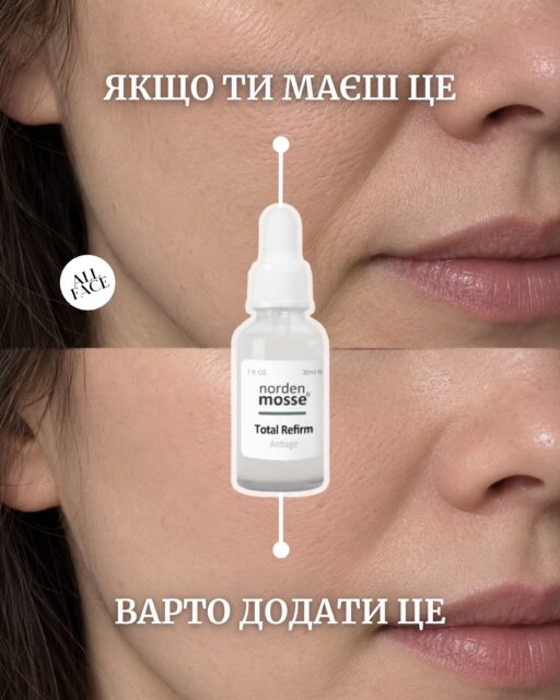 СЕРУМИ-РЯТІВНИКИ? А ТАК БУВАЄ? 😱

Одна вдало підібрана баночка справді може помітно змінити стан шкіри. Але щоб результат був не разовим, а залишався з вами, важливо мати правильну СХЕМУ догляду.

І ось тут ми можемо допомогти 🤍

На консультації ALL FACE розбираємося, що відбувається зі шкірою, чого їй зараз хочеться і що вже є на вашій поличці 👀 А потім разом збираємо догляд від А до Я — без десяти зайвих баночок і засобів «бо всі його радять».

Тільки те, що справді потрібно саме вашій шкірі 🫶🏻

Хочете розібрати свій догляд? Залишайте будь-який коментар під цим дописом ⤵️

Можна онлайн або офлайн у наших просторах у Києві та Одесі ✨