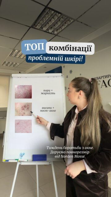 ПРОБЛЕМНА ШКІРА? РОЗБЕРЕМО ТРИ ЗАПИТИ ТА ЩО З НИМИ РОБИТИ 👇

🔹 Розширені пори + жирність
→ ензимна пудра 2–3 рази на тиждень + ніацинамід із цинком у ранковому догляді.

🔹 Висипи + постакне
→ лінолева кислота вранці + ретиналь увечері.

🔹 Комедони + тьмяний тон
→ ніацинамід 22% уранці, якщо шкіра добре його переносить, + бензоїл пероксид 2.5% увечері.

Засоби й активи важливо підбирати під стан шкіри та вводити поступово — особливо якщо вона чутлива або ви вже використовує активний догляд.

Залишайте будь-який коментар — надішлемо в Директ посилання на всі засоби з відео 💌 

А ще розповімо про подарунок, який можна отримати після онлайн-консультації в ALL FACE цього тижня: засіб із ВНА і цинком від Norden Mosse.

Напишіть коментар — і ми надішлемо вам деталі в Директ 🤍