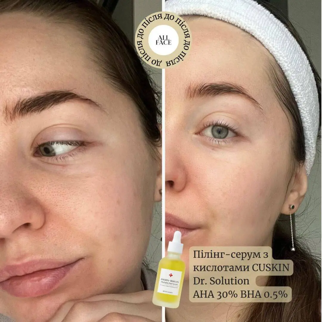 PRASADA SERUM & SKINPROTECT CREAM セット SESDERMA Azelac RU Facial Lipsomal Serum - 30ml USA